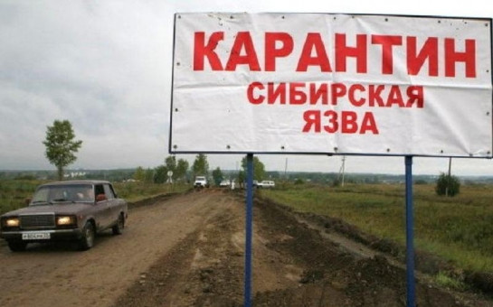 Сибирская язва